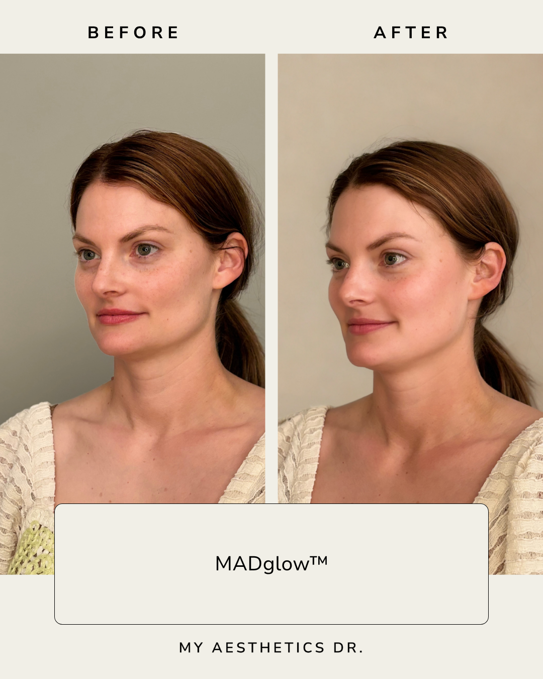 MADglowAshevilleNCfacial.png