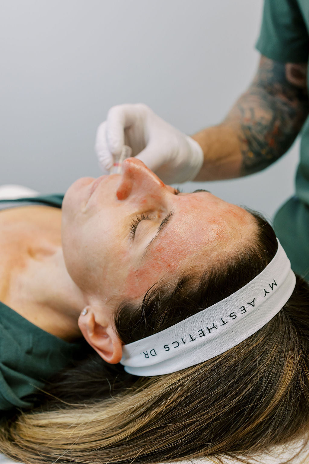 microneedling_hendersonville_nc.jpg