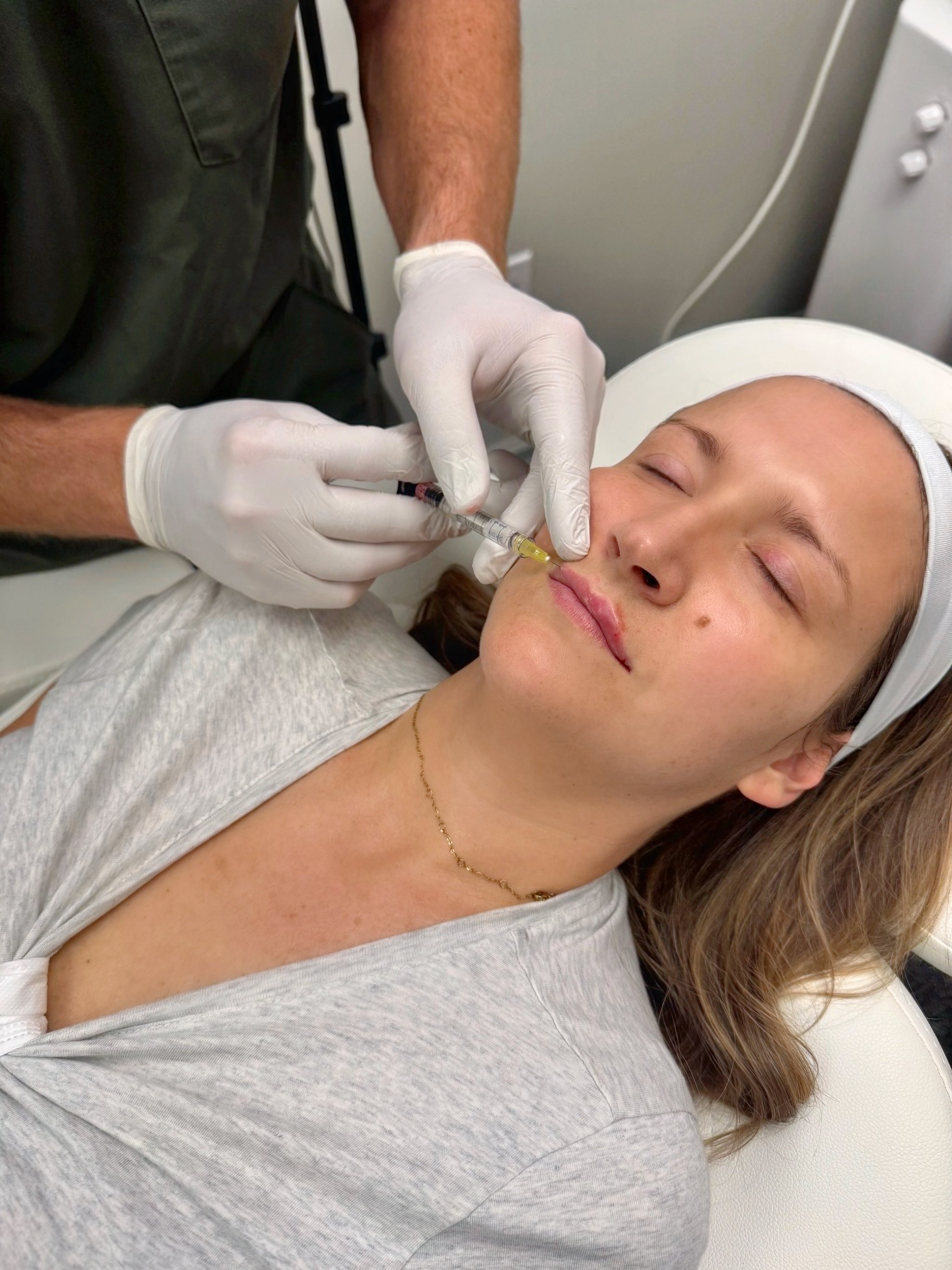 Lip_Filler_Ashleville.heic