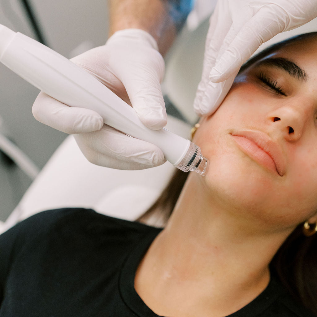 Microneedling_Asheville_NC_medical_Spa_Facial.jpg