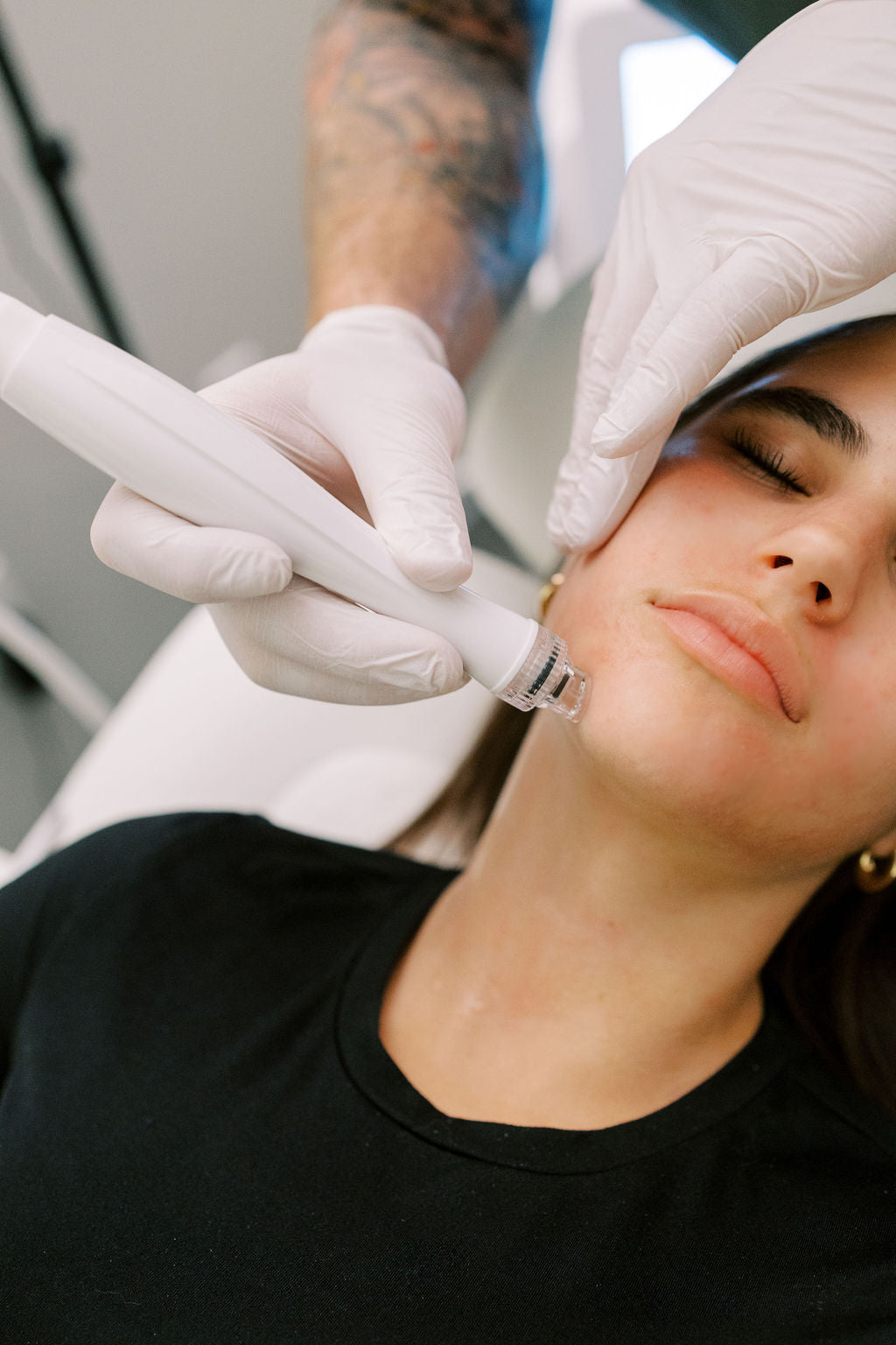 Microneedling_Asheville_NC_medical_Spa_Facial.jpg