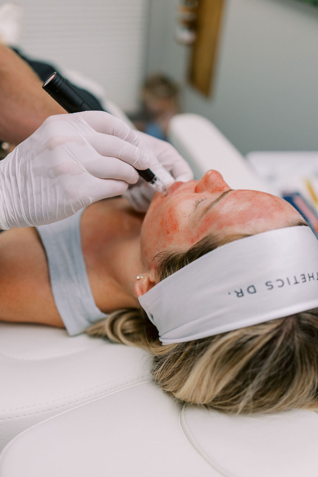 Microneedling_Asheville_NC_medical_Spa_Mills_River.jpg