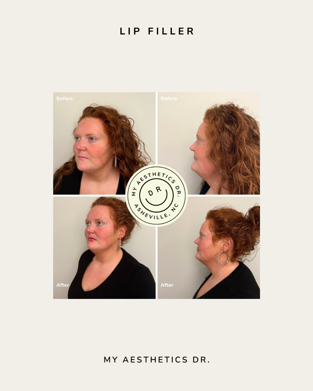filler_in_asheville_nc_d9a8d3f5-e8c3-4d7c-b60e-ac83d2792177.png