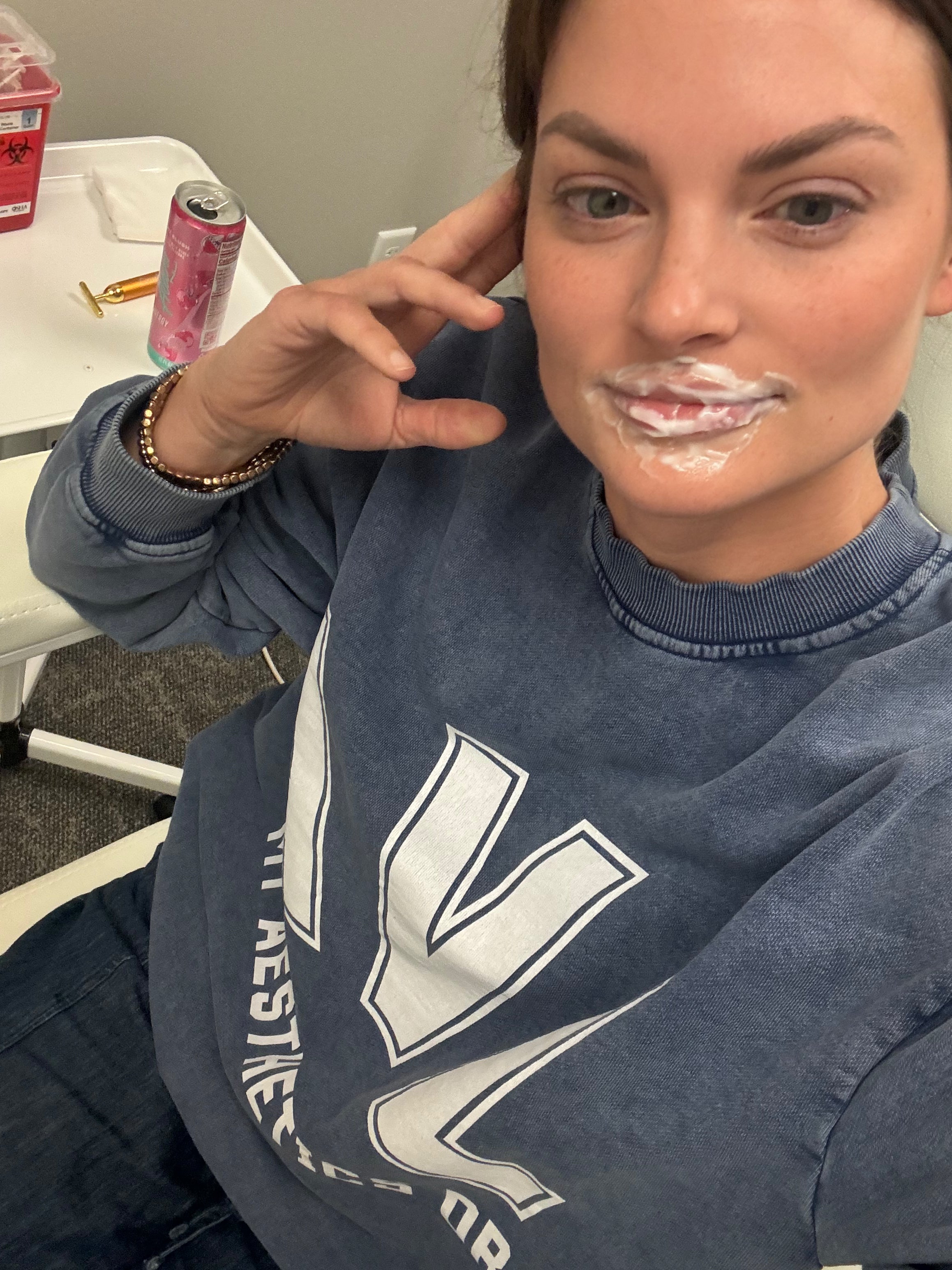 lip_filler_touch_up_asheville_nc.heic