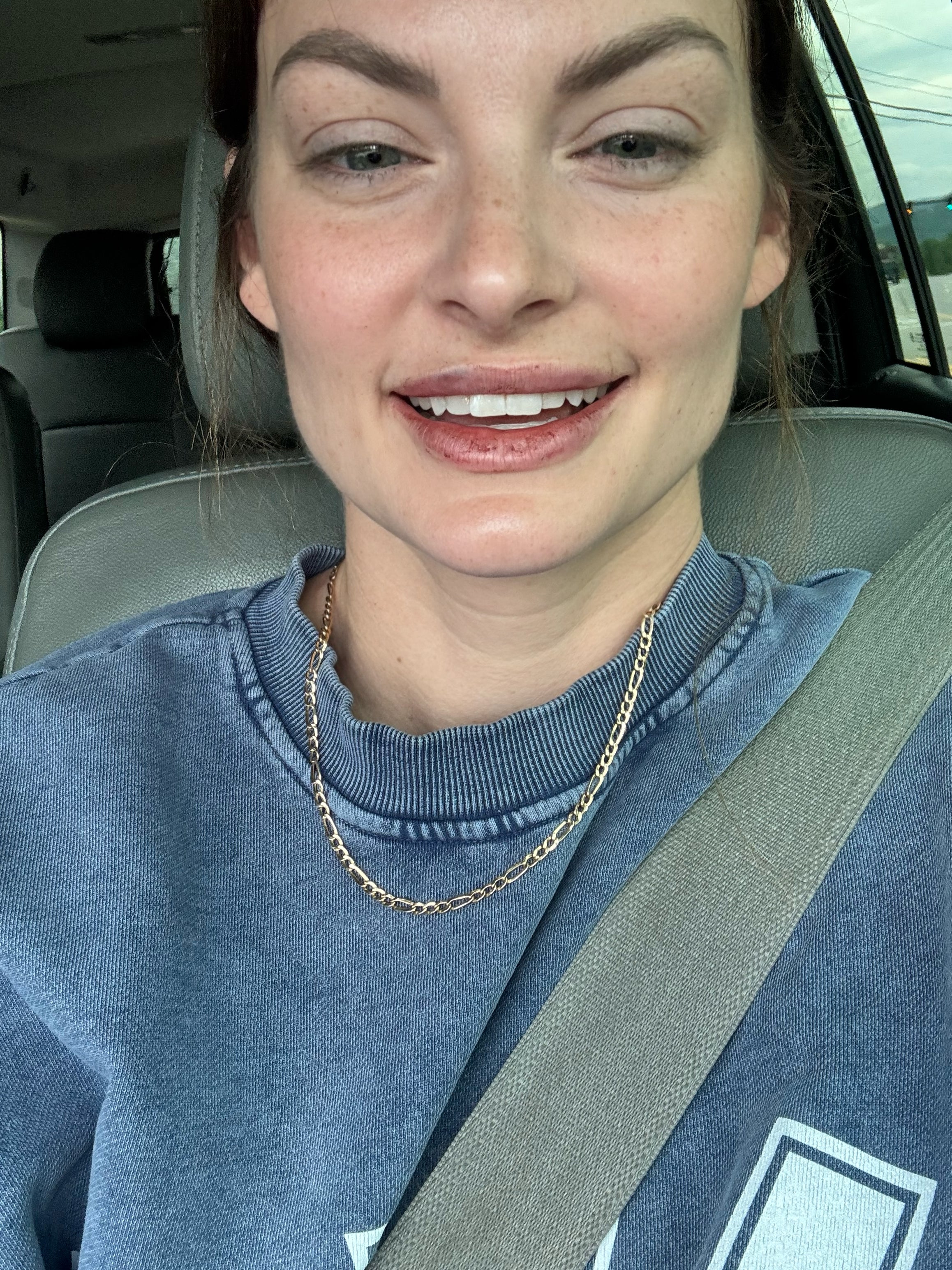 lip_filler_touch_up_asheville_north_carolina.heic